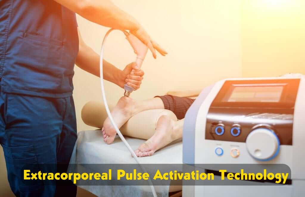 Extracorporeal Pulse Activation Technology